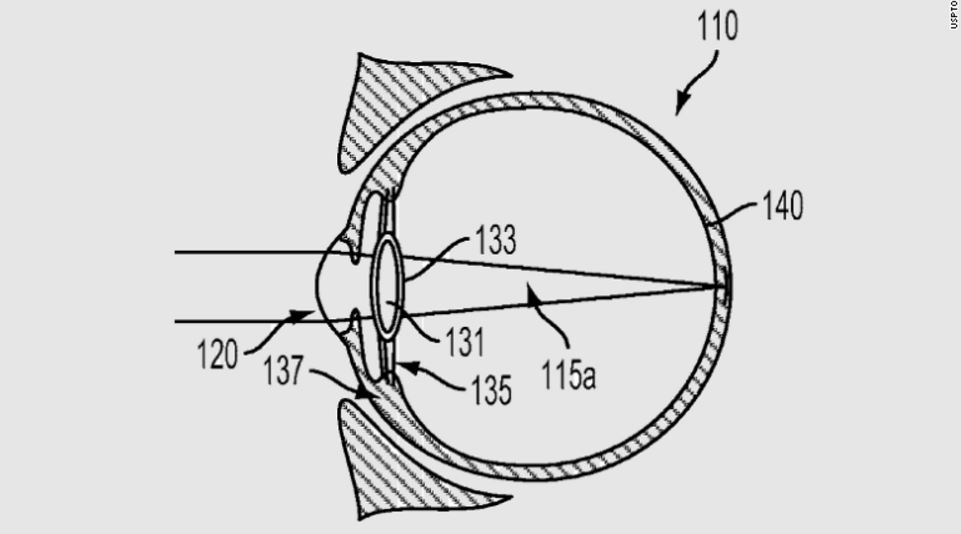 Eye-Lenses
