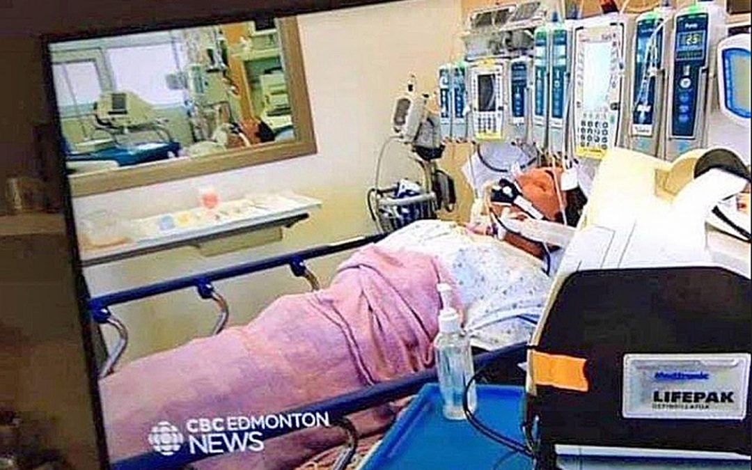 CBC Edmonton news report featuring a mannequin was filmed at a training facility, not in a hospital Intensive Care Unit